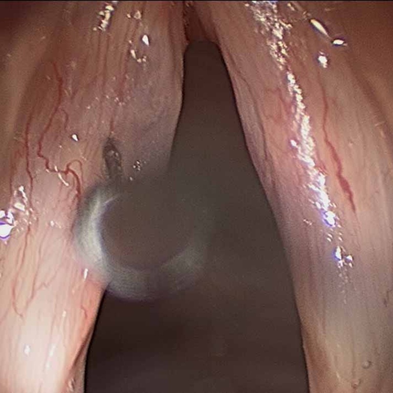 022%20sulcus.jpg