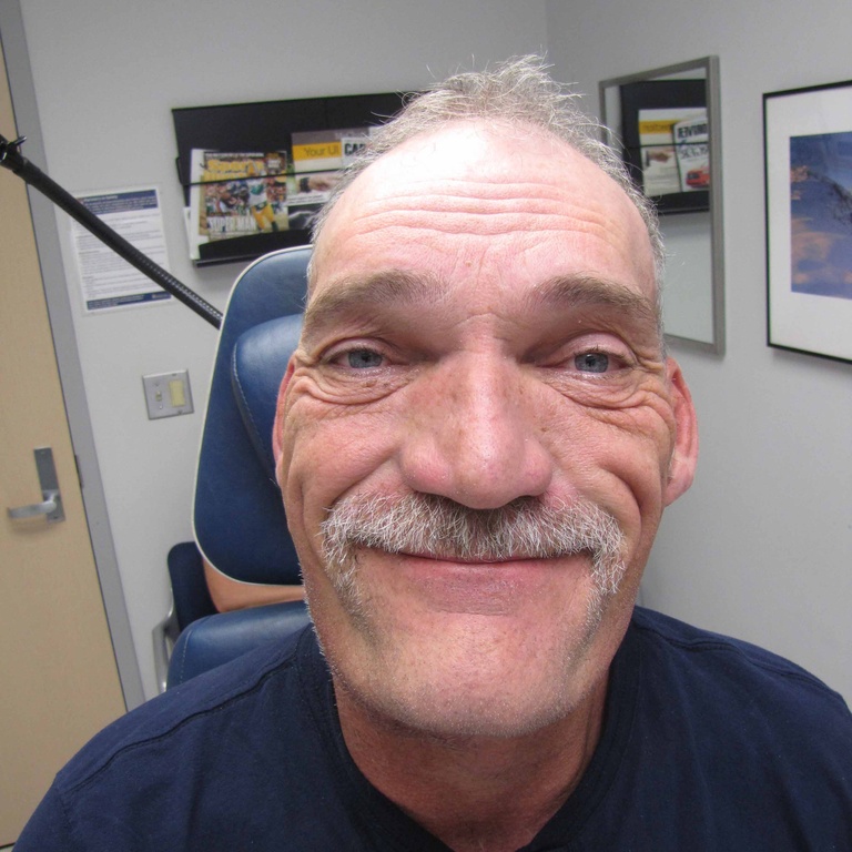 POD#8 with facial nerve function intact