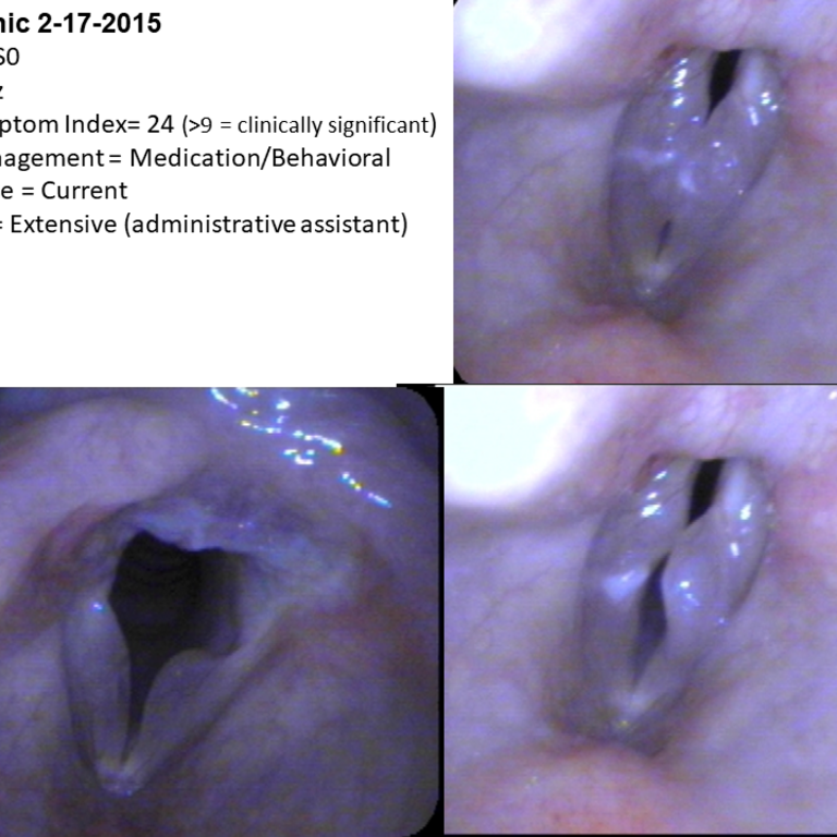 Dysphonia 2015