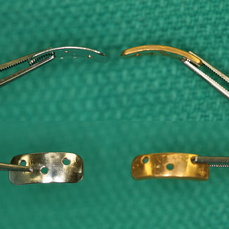 implants.jpg