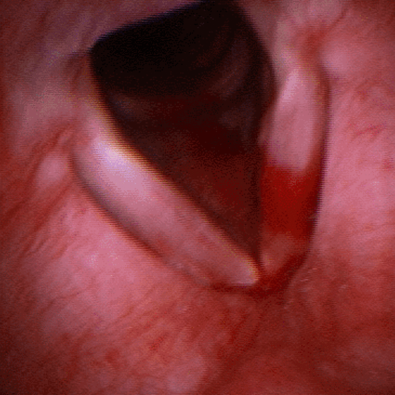 tnepolyp100709f.gif