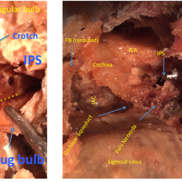 Figure 14-3.jpg
