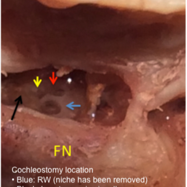 Figure 17